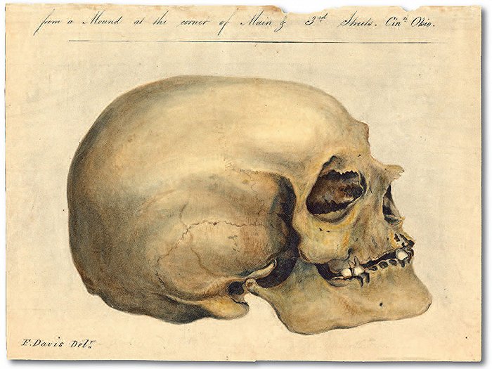 莫顿颅骨收藏中的其中一件，图片来自美国哲学学会