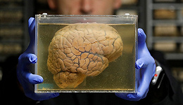 从“缸中之脑”到“芯片之脑”：当大脑离开身体 你何以成为你自己？